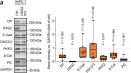 Fig.2.A showing Western Blotting in a Mus musculus (House mouse) sample from the publication: Adhesion of pancreatic tumor cell clusters by desmosomal molecules enhances early liver metastases formation.