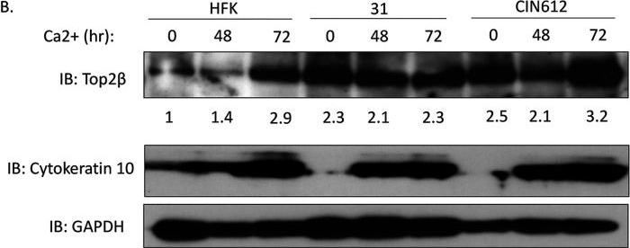 Fig.1.B showing Western Blotting from the publication: Topoisomerase 2β Induces DNA Breaks To Regulate Human Papillomavirus Replication.