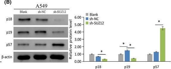 Fig.8.B showing Western Blotting from the publication: The expression and role of SUZ12 in lung adenocarcinoma.