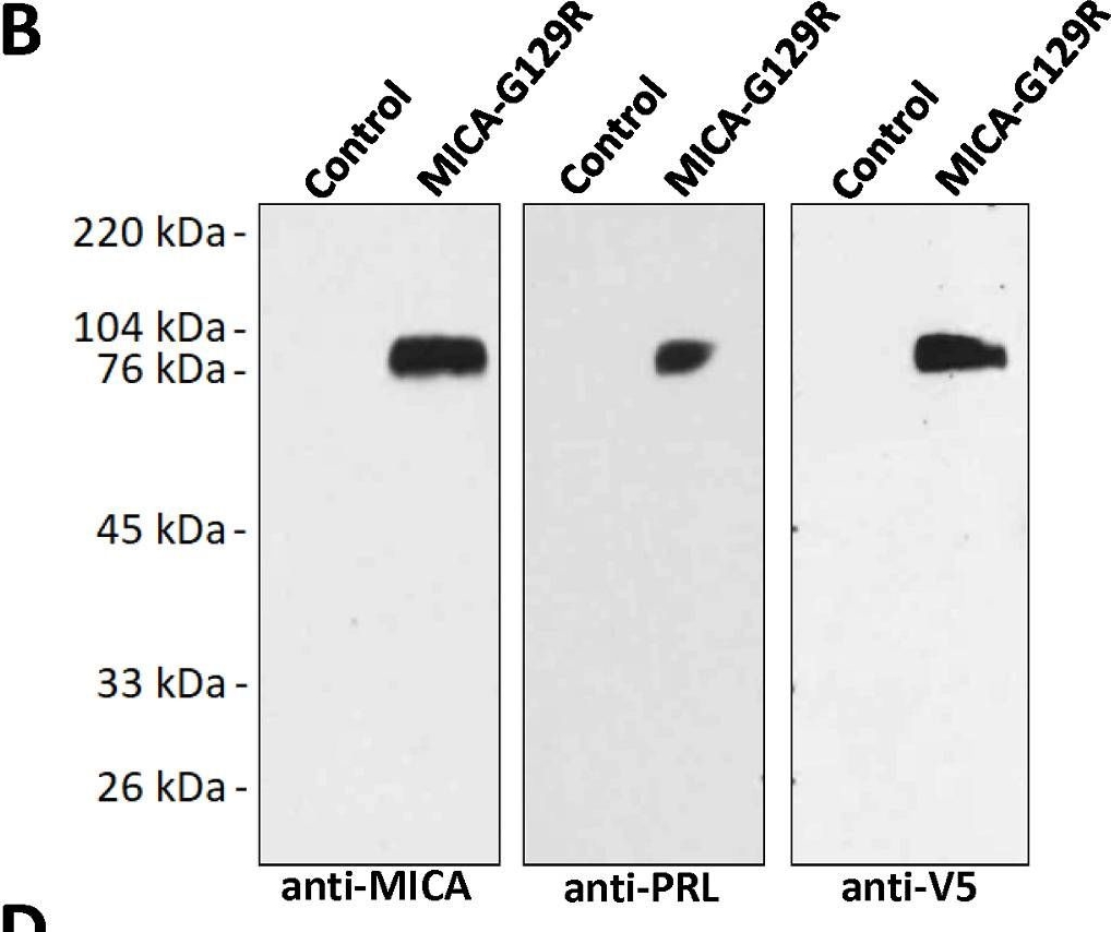 Fig.1.B showing Western Blotting from the publication: MICA-G129R: A bifunctional fusion protein increases PRLR-positive breast cancer cell death in co-culture with natural killer cells.