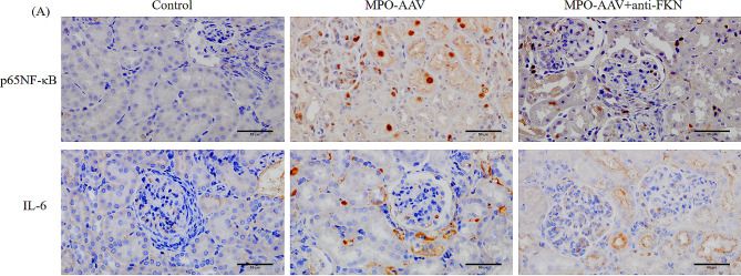 Fig.7.A showing Immunohistochemistry in a Rattus norvegicus (Rat) sample from the publication: Expression and significance of Fractalkine/CX3CL1 in MPO-AAV-associated glomerulonephritis rats.