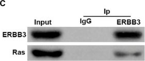 Fig.4.C showing Western Blotting in a Homo sapiens (Human) sample from the publication: ERBB3 Promotes Malignant Behaviors of Endometrial Cancer Cells with Involvement of the Ras-ERK/MAPK Signaling Pathway.