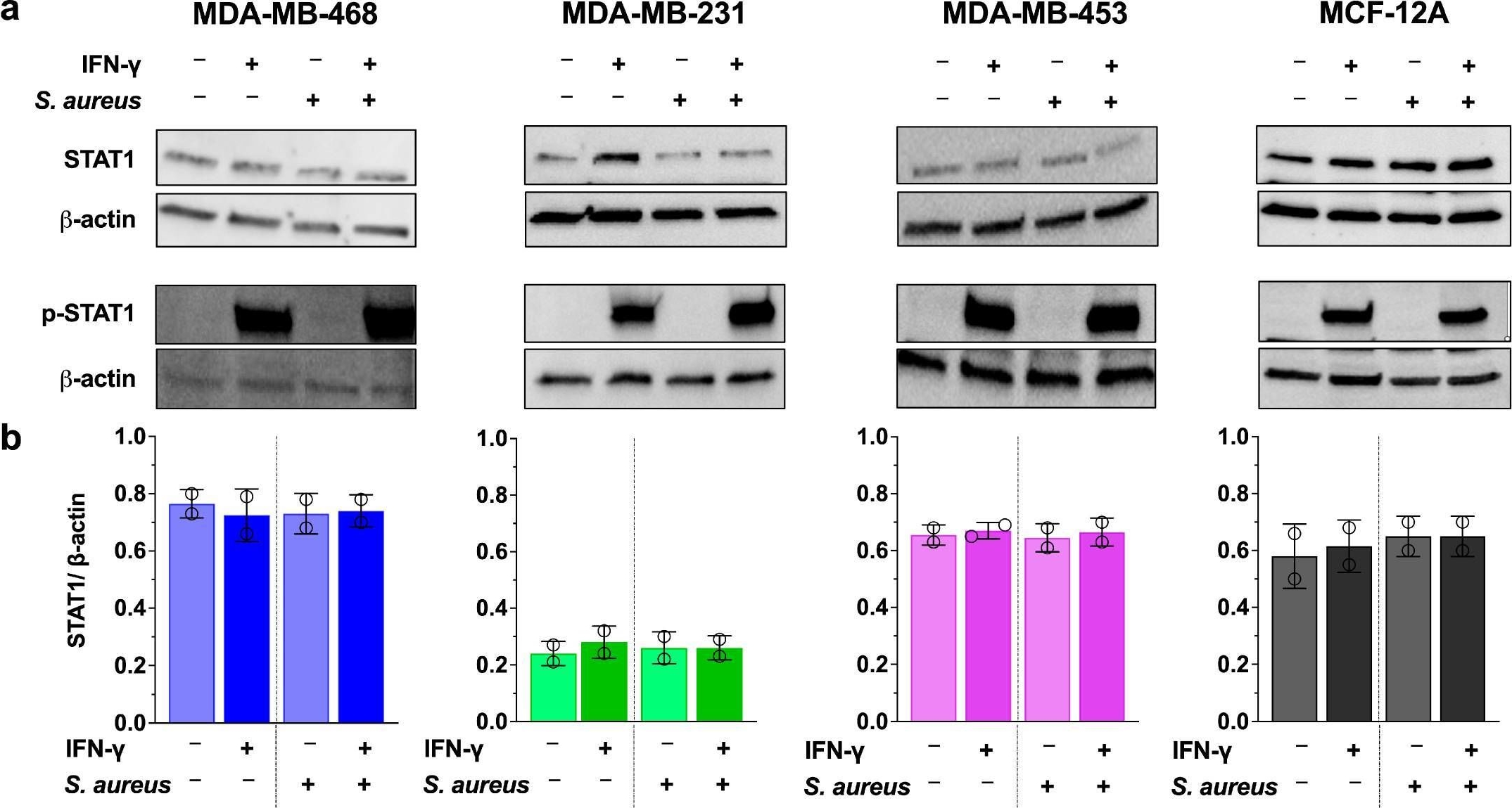 Fig.4.A showing Western Blotting from the publication: Cell Line-Dependent Internalization, Persistence, and Immunomodulatory Effects of Staphylococcus aureus in Triple-Negative Breast Cancer.