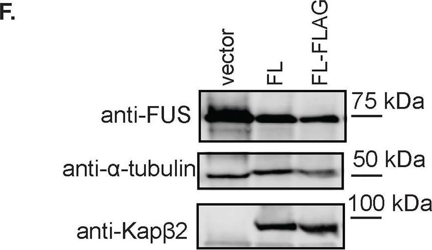 Fig.1.F showing Western Blotting from the publication: A minimal construct of nuclear-import receptor Karyopherin-β2 defines the regions critical for chaperone and disaggregation activity.