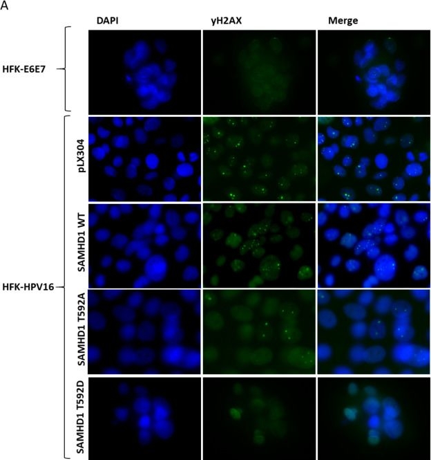 Fig.4.A showing Immunocytochemistry-immunofluorescence from the publication: Human papillomavirus 16 replication converts SAMHD1 into a homologous recombination factor and promotes its recruitment to replicating viral DNA.