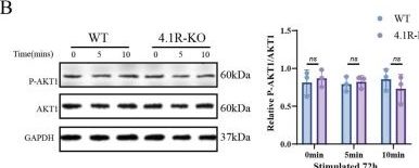 Fig.4.B showing Western Blotting in a Mus musculus (House mouse) sample from the publication: Cytoskeletal Protein 4.1R Inhibits BCR-Mediated B-Cell Activation by Restraining AKT1 Phosphorylation.