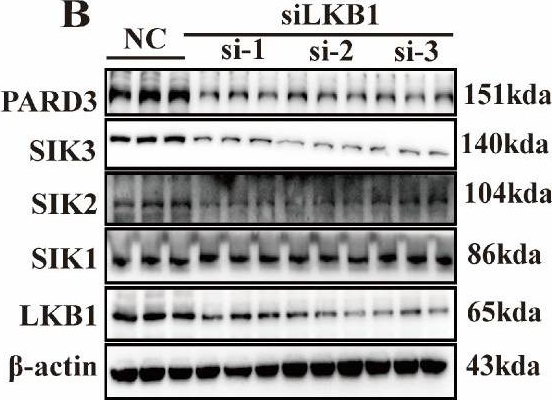 Fig.6.B showing Western Blotting from the publication: Discovery of the Natural Bibenzyl Compound Erianin in Dendrobium Inhibiting the Growth and EMT of Gastric Cancer through Downregulating the LKB1-SIK2/3-PARD3 Pathway.