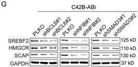 Fig.5.G showing Western Blotting in a Homo sapiens (Human) sample from the publication: A Super-Enhancer-Driven Transcriptional Regulatory Circuit Underlying Abiraterone Resistance in Castration-Resistant Prostate Cancer.