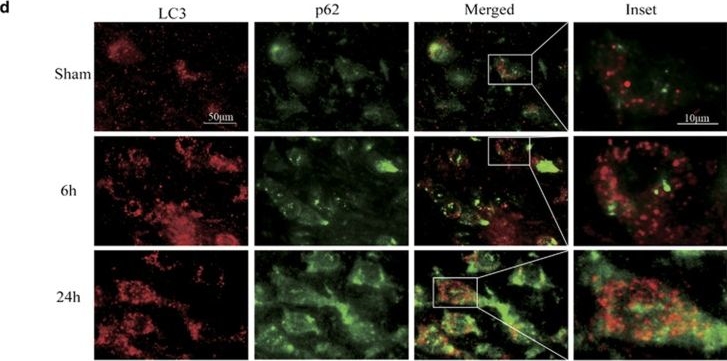Impaired autophagosome clearance contributes to neuronal death in a piglet model of neonatal hypoxic-ischemic encephalopathy.