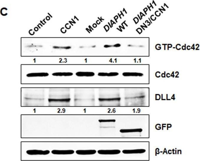 Fig.4.C showing Western Blotting in a Homo sapiens (Human) sample from the publication: CCN1 interlinks integrin and hippo pathway to autoregulate tip cell activity.