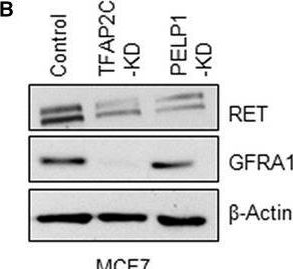 Fig.5.B showing Western Blotting in a Homo sapiens (Human) sample from the publication: Interaction of transcription factor AP-2 gamma with proto-oncogene PELP1 promotes tumorigenesis by enhancing RET signaling.