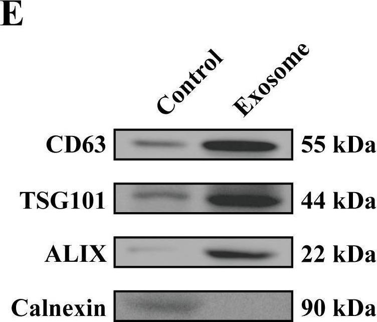 Fig.1.E showing Western Blotting from the publication: Tumor-derived exosomal lncRNA SNHG4 promotes triple-negative breast cancer progression by targeting XPO5.