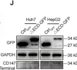 Fig.2.J showing Western Blotting from the publication: Targeting autophagy in HCC treatment: exploiting the CD147 internalization pathway.