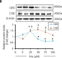 Fig.1.B showing Western Blotting in a Mus musculus (House mouse) sample from the publication: H2S and homocysteine control a novel feedback regulation of cystathionine beta synthase and cystathionine gamma lyase in cardiomyocytes.