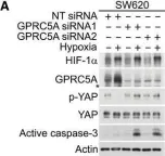 Fig.4.A showing Western Blotting from the publication: Cancer cell adaptation to hypoxia involves a HIF-GPRC5A-YAP axis.