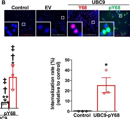 Fig.2.B showing Immunocytochemistry-immunofluorescence from the publication: SRC-mediated phosphorylation of UBC9 regulates inflammatory and metabolic signaling in alcohol-associated liver disease.