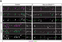 Fig.5.A showing Immunocytochemistry-immunofluorescence from the publication: EphrinB2 regulates VEGFR2 during dendritogenesis and hippocampal circuitry development.