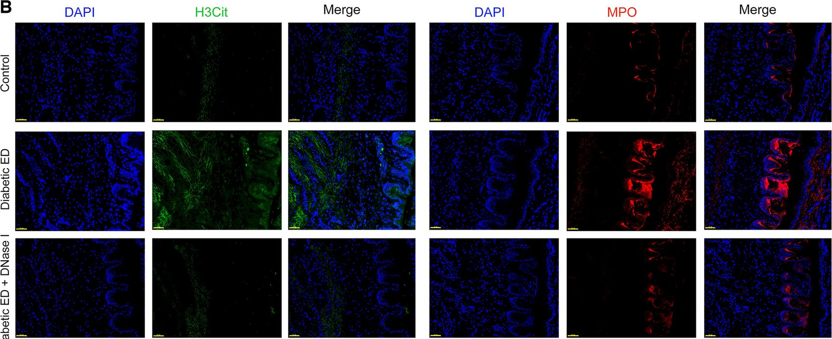 Fig.4.B from the publication: Neutrophil extracellular traps promote erectile dysfunction in rats with diabetes mellitus by enhancing NLRP3-mediated pyroptosis.