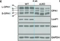 Fig.2.E showing Western Blotting from the publication: LonP1 Links Mitochondria-ER Interaction to Regulate Heart Function.