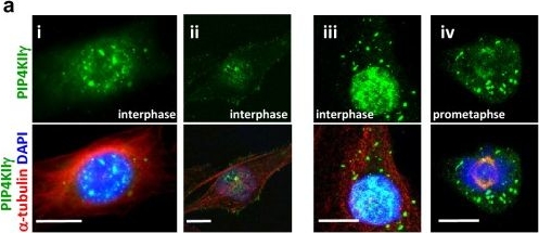 Fig.1.A showing Immunocytochemistry in a Homo sapiens (Human) sample from the publication: Phosphatidylinositol-5-phosphate 4-kinase gamma accumulates at the spindle pole and prevents microtubule depolymerization.