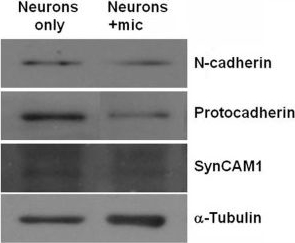Fig.8.A showing Western Blotting in a Mus musculus (House mouse) sample from the publication: Microglia actively regulate the number of functional synapses.