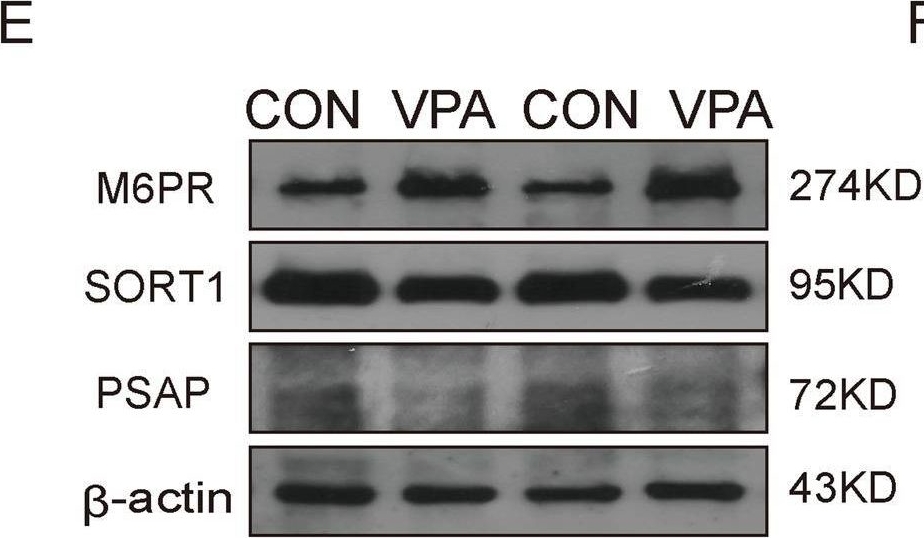Fig.6.E showing Western Blotting in a Rattus norvegicus (Rat) sample from the publication: Progranulin improves neural development via the PI3K/Akt/GSK-3β pathway in the cerebellum of a VPA-induced rat model of ASD.
