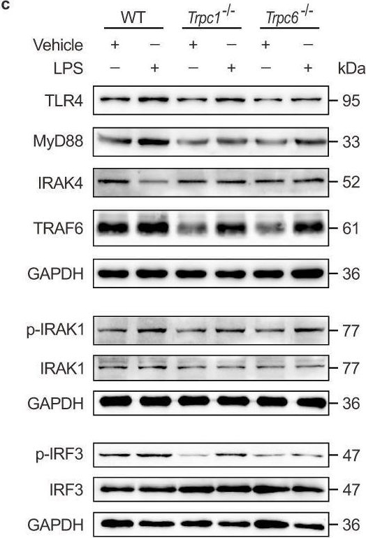 Fig.3.C showing Western Blotting in a Mus musculus (House mouse) sample from the publication: TRPC channels blockade abolishes endotoxemic cardiac dysfunction by hampering intracellular inflammation and Ca2+ leakage.