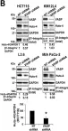 Fig.3.B showing Western Blotting from the publication: Vasodilator-stimulated phosphoprotein promotes liver metastasis of gastrointestinal cancer by activating a β1-integrin-FAK-YAP1/TAZ signaling pathway.