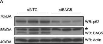 Fig.3.A showing Western Blotting from the publication: BAG5 Promotes Alpha-Synuclein Oligomer Formation and Functionally Interacts With the Autophagy Adaptor Protein p62.