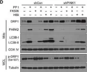 Fig.6.D showing Western Blotting in a Homo sapiens (Human) sample from the publication: Polyphyllin I induces mitophagic and apoptotic cell death in human breast cancer cells by increasing mitochondrial PINK1 levels.
