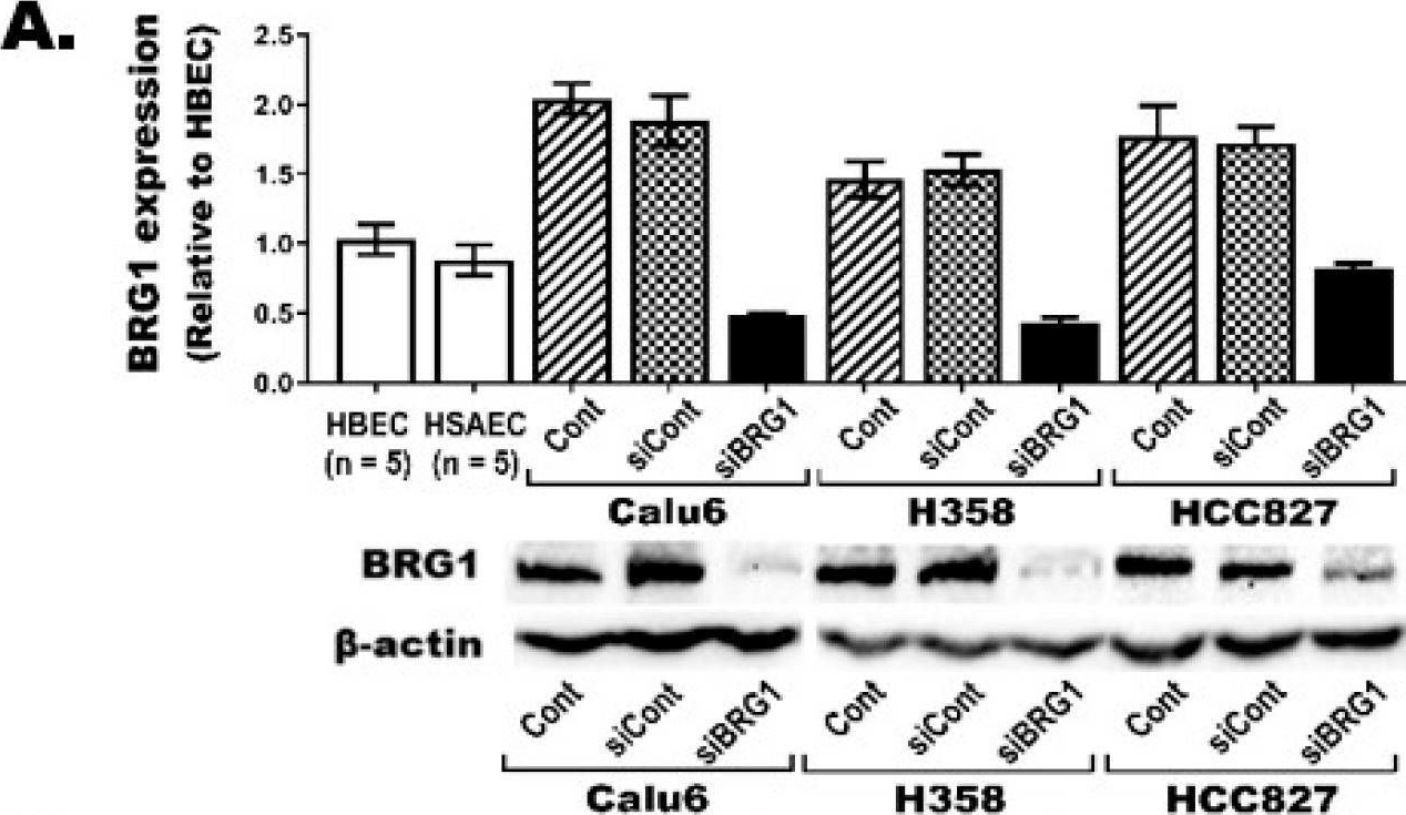 Fig.2.A showing Western Blotting in a Homo sapiens (Human) sample from the publication: BRG1 Loss Is Frequent in Lung Cancer and Transforms Lung Epithelial Cells via Transcriptional and Epigenetic Reprograming.