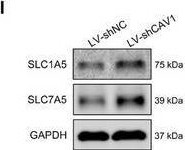 Fig.6.I showing Western Blotting in a Mus musculus (House mouse) sample from the publication: Targeting Caveolin-1 in Multiple Myeloma Cells Enhances Chemotherapy and Natural Killer Cell-Mediated Immunotherapy.