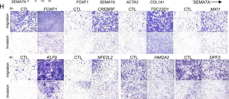 Fig.4.H showing Immunohistochemistry from the publication: HER2 drives lung fibrosis by activating a metastatic cancer signature in invasive lung fibroblasts.