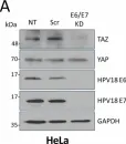 Fig.2.A showing Western Blotting in a Homo sapiens (Human) sample from the publication: The Hippo pathway transcription factors YAP and TAZ play HPV-type dependent roles in cervical cancer.
