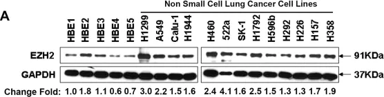 Fig.1.A showing Western Blotting from the publication: EZH2 promotes malignant behaviors via cell cycle dysregulation and its mRNA level associates with prognosis of patient with non-small cell lung cancer.