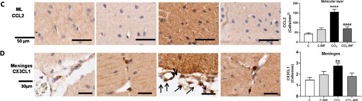 Fig.6.C showing Immunohistochemistry from the publication: Rifaximin Prevents T-Lymphocytes and Macrophages Infiltration in Cerebellum and Restores Motor Incoordination in Rats with Mild Liver Damage.