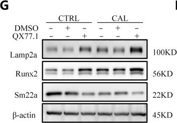 Fig.3.G showing Western Blotting from the publication: HSP90AA1 Facilitates Vascular Calcification in Chronic Kidney Disease Involving Chaperone-Mediated Autophagy.