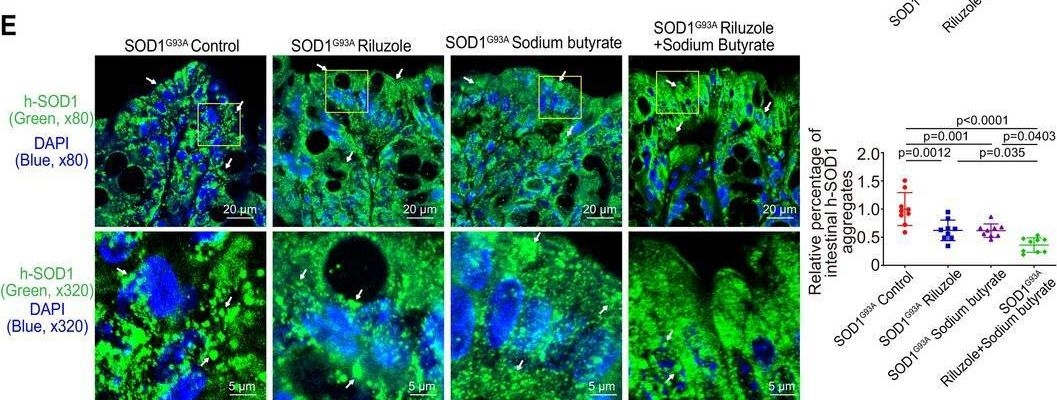 Fig.2.E showing Immunohistochemistry-immunofluorescence in a Mus musculus (House mouse) sample from the publication: Synergistic Effects of Riluzole and Sodium Butyrate on Barrier Function and Disease Progression of Amyotrophic Lateral Sclerosis Through the Gut-Neuron Axis.