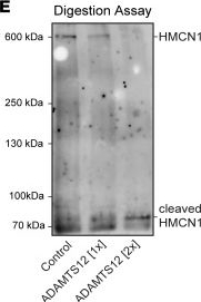 Fig.7.E showing Western Blotting from the publication: ADAMTS12 promotes fibrosis by restructuring extracellular matrix to enable activation of injury-responsive fibroblasts.