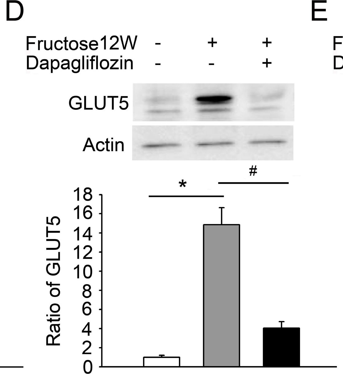 Fig.3.D showing Western Blotting in a Rattus norvegicus (Rat) sample from the publication: Dapagliflozin Prevents NOX- and SGLT2-Dependent Oxidative Stress in Lens Cells Exposed to Fructose-Induced Diabetes Mellitus.