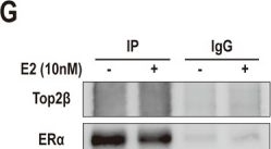 Fig.5.G showing Western Blotting in a Homo sapiens (Human) sample from the publication: Estradiol increases risk of topoisomerase IIβ-mediated DNA strand breaks to initiate Xp11.2 translocation renal cell carcinoma.