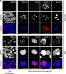 Fig.1.E showing Immunocytochemistry-immunofluorescence in a Caenorhabditis elegans sample from the publication: H3.3K27M-induced chromatin changes drive ectopic replication through misregulation of the JNK pathway in C. elegans.