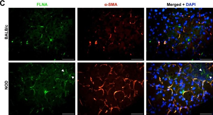 Fig.6.C showing Immunohistochemistry-immunofluorescence in a Mus musculus (House mouse) sample from the publication: Quantitative Changes in the Proteome of Chronically Inflamed Lacrimal Glands From a Sjögren's Disease Animal Model.