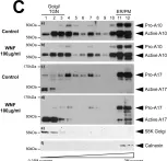 Fig.5.C showing Western Blotting from the publication: The Polyherbal Wattana Formula Displays Anti-Amyloidogenic Properties by Increasing α-Secretase Activities.