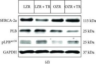 Fig.7.D showing Western Blotting in a Rattus norvegicus (Rat) sample from the publication: Exercise Training Restores Cardiac MicroRNA-1 and MicroRNA-29c to Nonpathological Levels in Obese Rats.