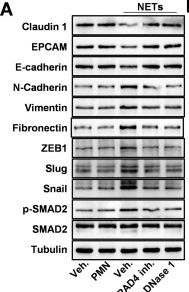 Fig.3.A showing Western Blotting from the publication: Mechanistic and functional characterization of NETs/IL-17 as a therapeutic target in EMT and brain metastasis of lung adenocarcinoma.