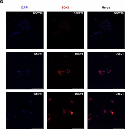Fig.5.G showing Immunocytochemistry-immunofluorescence in a Mus musculus (House mouse) sample from the publication: Elucidating the roles of microRNA-103a-3p in trophoblast invasion and SOX4-mediated extravillous differentiation induced by activin A.