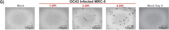 Fig.2.G from the publication: Seasonal human coronaviruses OC43, 229E, and NL63 induce cell surface modulation of entry receptors and display host cell-specific viral replication kinetics.