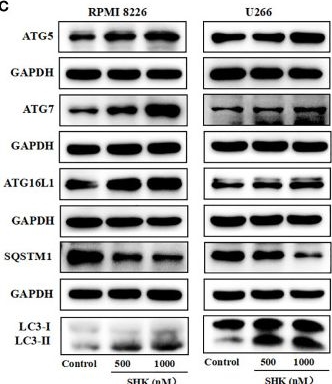 Fig.5.C showing Western Blotting from the publication: Shikonin induces ferroptosis in multiple myeloma via GOT1-mediated ferritinophagy.