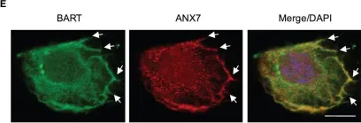 Fig.1.E showing Immunocytochemistry-immunofluorescence from the publication: BART inhibits pancreatic cancer cell invasion by PKCα inactivation through binding to ANX7.